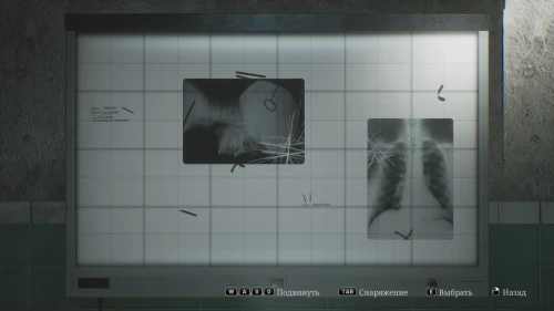 Silent Hill 2 Remake Hospital X-Ray Puzzle: How to Solve and Get the D1 Room Code